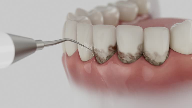 Trusted Teeth Cleaning And Checkup service in Waterville, OH - Dentist Open Now